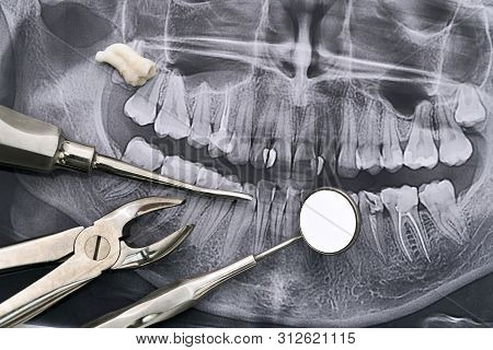 Dental Instruments With Tooth Lying On Orthopantomogram