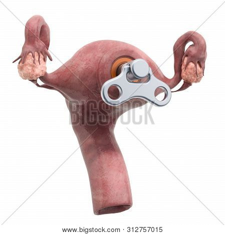Human Uterus With Wind-up Key. Treatment And Recovery Concept. 3d Rendering Isolated On White Backgr