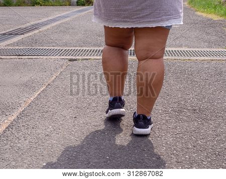 Close Up Leg Fat Women Running Shoes Is Walking On The Street Alone.