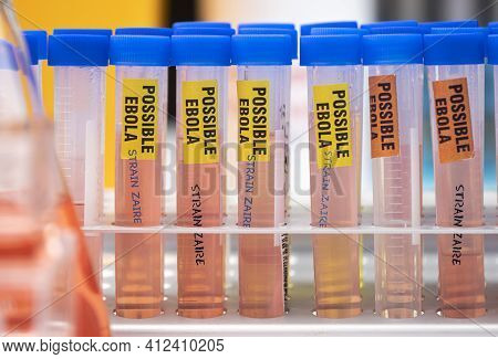 Sample Vials Of Possible Ebola Patients Infected With New Zaire Strain Of Ebola, Concept Image