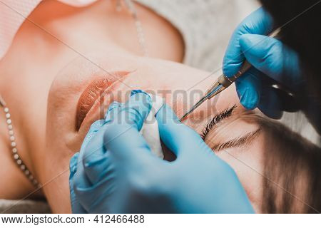 Mechanical Cleansing Of The Face With A Spoon Uno, Removing Grease And Blackheads.