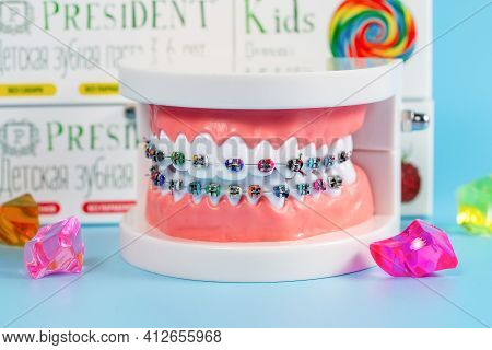 Moscow, Russia - 9th Matra 2021: Childrens Toothpastes And Artificial Jaw With Colored Braces On A B