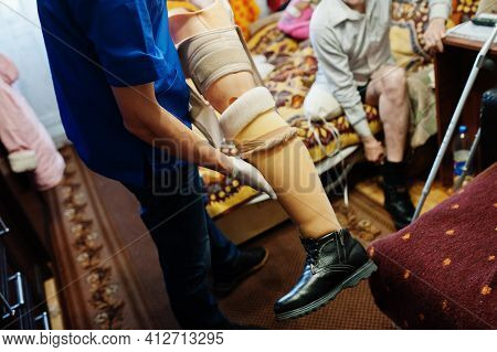 The Prosthetist Removes The Measure From A Person With A Disability, Man With Amputee.