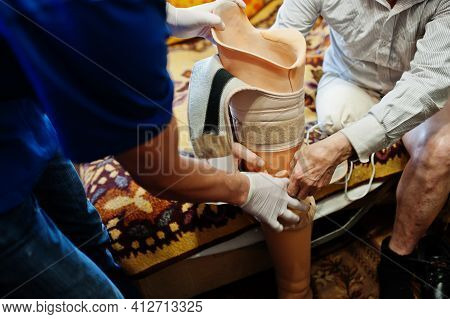 The Prosthetist Removes The Measure From A Person With A Disability, Man With Amputee.