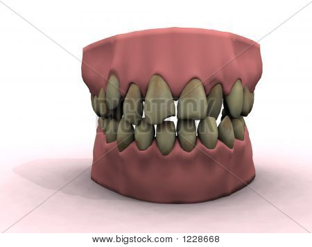 Badteeth3