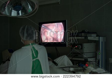City Gomel, Belarus.May 31, 2017 Gomel medical hospital.Doctors in the operating room do laparoscopy.The operation of internal organs of man.Profession surgeon