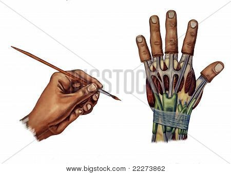 กลุ่มอาการอุโมงค์ carpal