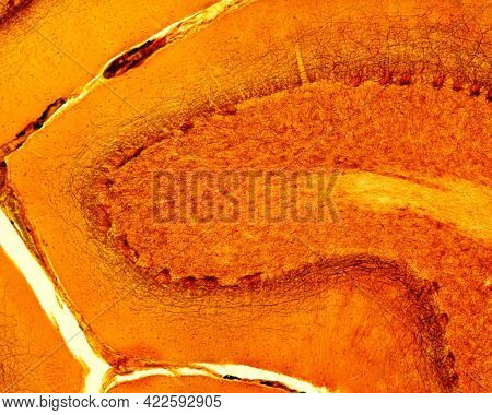 Light Micrograph Of The Cerebellar Cortex Stained With Cajal's Silver Nitrate Method. The Purkinje C