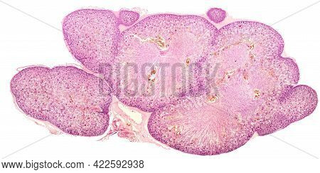Low Power Light Micrograph Of A Kidney From A 20 Week Old Foetus Showing Several Lobules With A Well