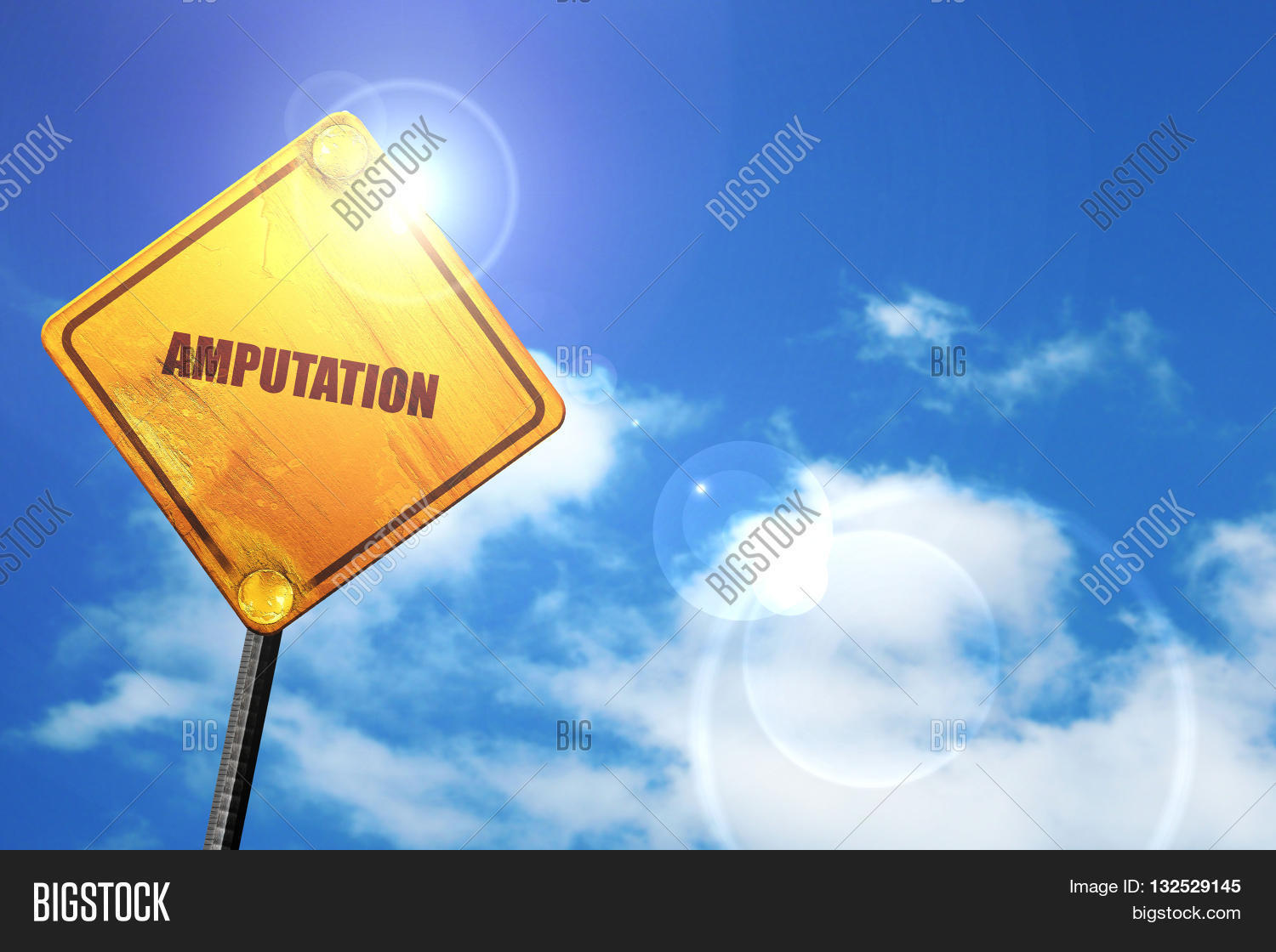 Amputation, 3D Image & Photo (Free Trial) | Bigstock