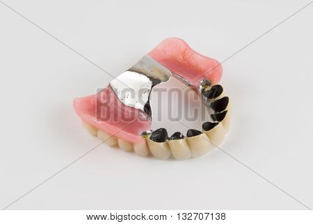 Clasp Prosthesis With And Latch Ceramic Crowns