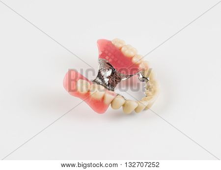 Clasp Prosthesis With And Latch Ceramic Crowns