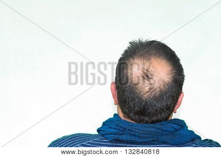 Mature yang man seen from behind in the head begins to lose hair he begins to be old.