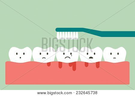 Brushing Teeth With Bleeding On Gum And Tooth, Gingivitis Or Scurvy Concept - Dental Cartoon Vector 