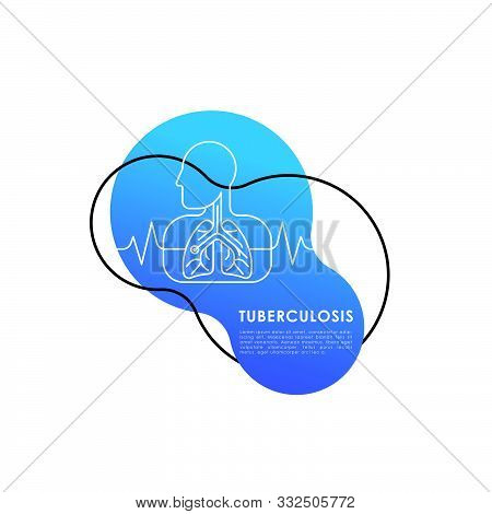 Tuberculosis. Tuberculosis Vector. Tuberculosis icon Vector. Tuberculosis Background. Tuberculosis design. Tuberculosis illustrations. Tuberculosis banner. Medical Tuberculosis. Tuberculosis Vector Background. Tuberculosis Medical Pulmonary vector illustr