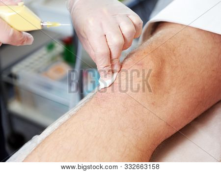 Carbon Dioxide Therapy (carboxytherapy). Skin Rejuvenation.the Procedure Is Performed On The Male Kn