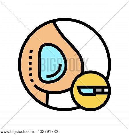 Implant Surgery Color Icon Vector. Implant Surgery Sign. Isolated Symbol Illustration