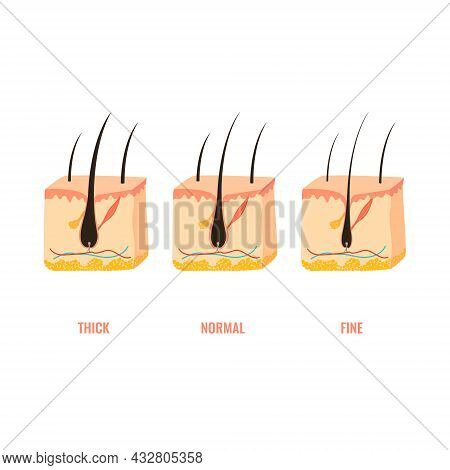 Hair Width Structure In Skin Cross-section Diagram