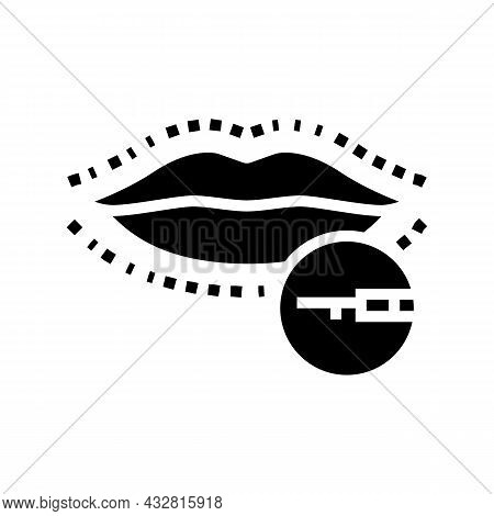 Lips Surgery Glyph Icon Vector. Lips Surgery Sign. Isolated Contour Symbol Black Illustration