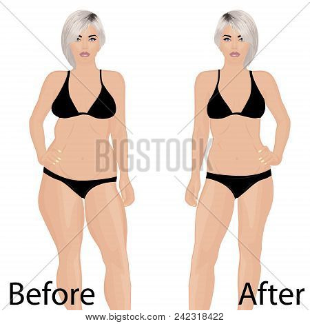Woman Body Correction. Liposuction. Before And After.  Vector Illustration