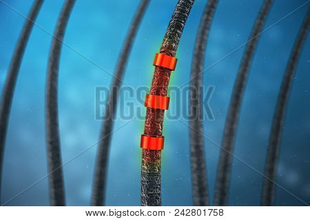 3d Rendering Weakened Hair. Concept Of Hair Loss. Unfortified, Unhealthy Hair. Hair With Under Micro
