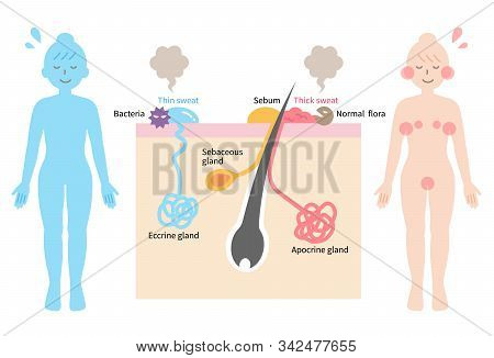 Sweating And Body Odor Are Caused By Sweat Glands In Human Body. Health Care Concept