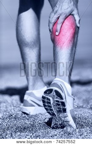 Muscle injury - Man running clutching calf muscle after spraining it while out jogging on the beach. Male athlete sport injury.
