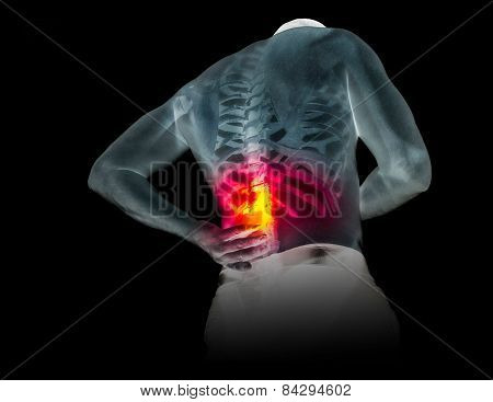 Human Skeleton Under The X-rays Isolated On Black Background