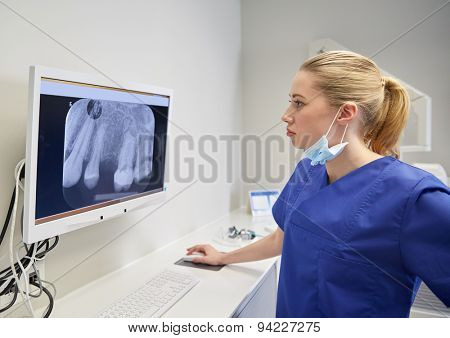 people, medicine, stomatology, technology and health care concept - female dentist looking to x-ray scan on monitor at dental clinic