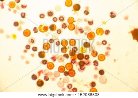 Eggs of tapeworm Taenia pork tapeworm , a helminth transmitted to humans by raw or undercooked meat. Light microphotograph, magnification X100