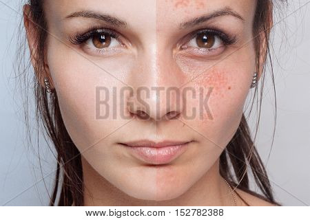 Before and after cosmetic operation. Young pretty woman portrait isolated on a white background. Before and after cosmetic or plastic procedure anti-age therapy