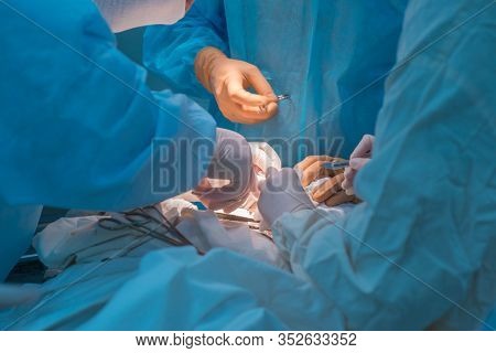 Close-up, The Hands Of Pediatric Surgeons And An Assistant Operating A Small Patient With Behind-the