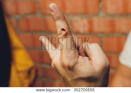 Bleeding Blood From The Cut Finger Wound. Injured Finger With Bleeding Open Cut Wound. Closeup Of Fi