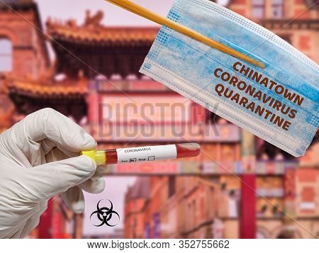 Chinatown Coronavirus Covid-19 World Outbreak Concept. Chopsticks Hold A Blooded Face Mask Above Han