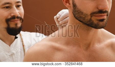 Needles For Acupuncture In A Mans Shoulder Close-up On A Brown Background. A Reflexologist Very Accu