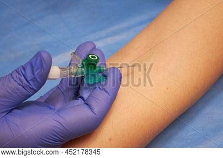 Preparation For Vein Catheterization Close Up. Intravenous Catheter In The Hands Of A Doctor