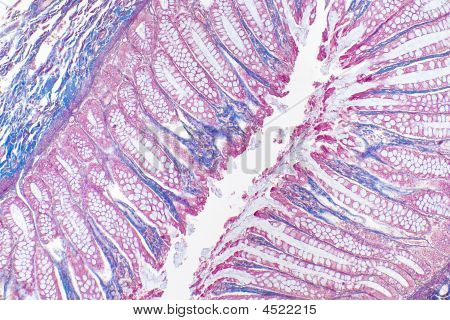 Auerbach Plexus
