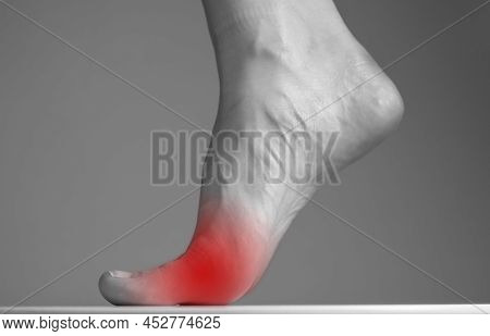 Woman Foot With Pain In Ball With Red Point Closeup. Intense Physical Activity, Inflammation Consequ