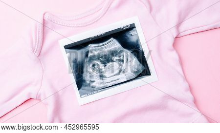 Ultrasound Picture Pregnant Baby Photo. Fashion Cute Baby Cloth With Ultrasound Pregnancy Image On P
