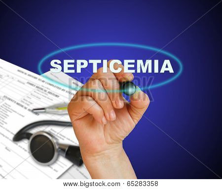 Septicemia