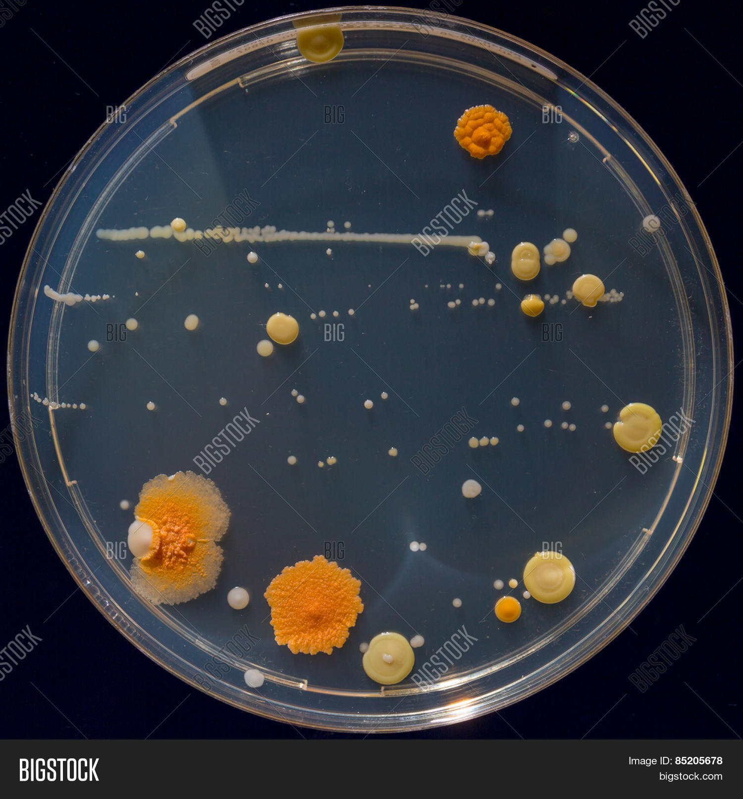 Petri Dish Colonies Image & Photo (Free Trial) Bigstock