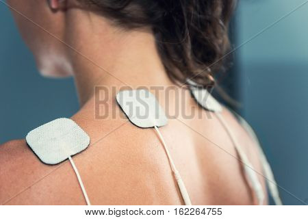 TENS electrodes - treatment on shoulders, toned horizontal image