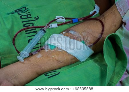 Patients with kidney disease on dialysis to perform the venipuncture.