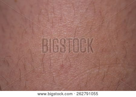 Depilation And Saccharification. Depilation. Follicle. Womans Legs The Process And Stages Of Depilat