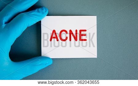 Hand In Blue Glove With White Card. Concept Word Acne.