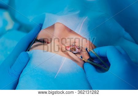 Laser Vision Correction. A Patient And Team Of Surgeons In The Operating Room