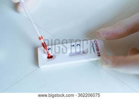Doctor In Gloves Doing Rapid Test For Viral Disease Covid-19, 2019-ncov. Test Kit Showing Negative R