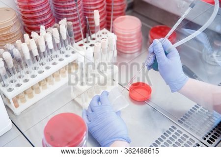 Microbiology Laboratory Agar Plate Full Of Micro Bacterias And Microorganisms E. Coli Grow Biologica