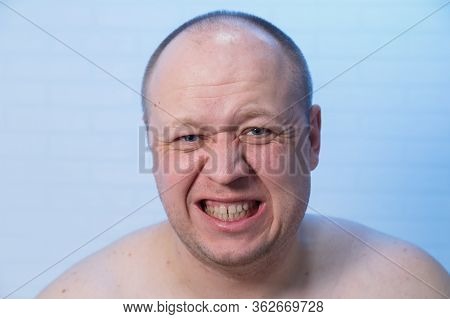 Portrait Of A Bald Man Who Writhes In Pain.