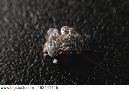 Close-up Of A Kidney Stone. Neoplasm Urolithiasis Of The Kidneys. Nephrolithiasis - Closeup Shot Of 